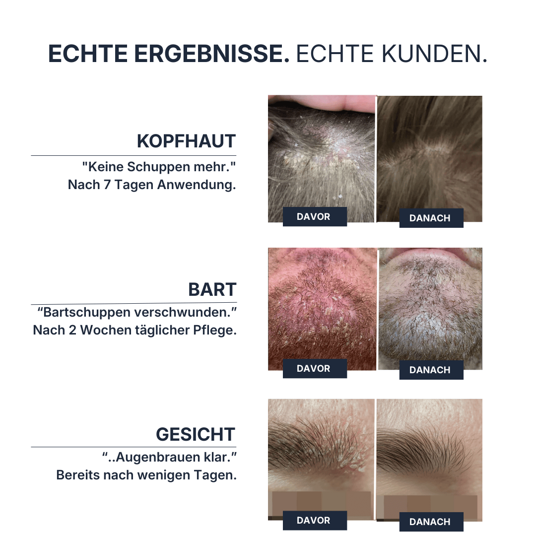 SebDerm® System